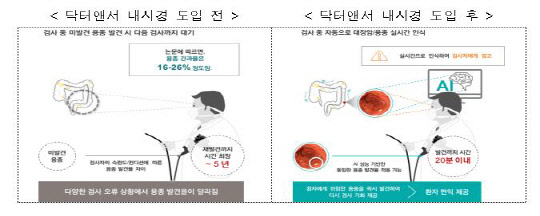 닥터앤서 내시경 도입 전과 후 진단정확도. 과학기술정보통신부 제공